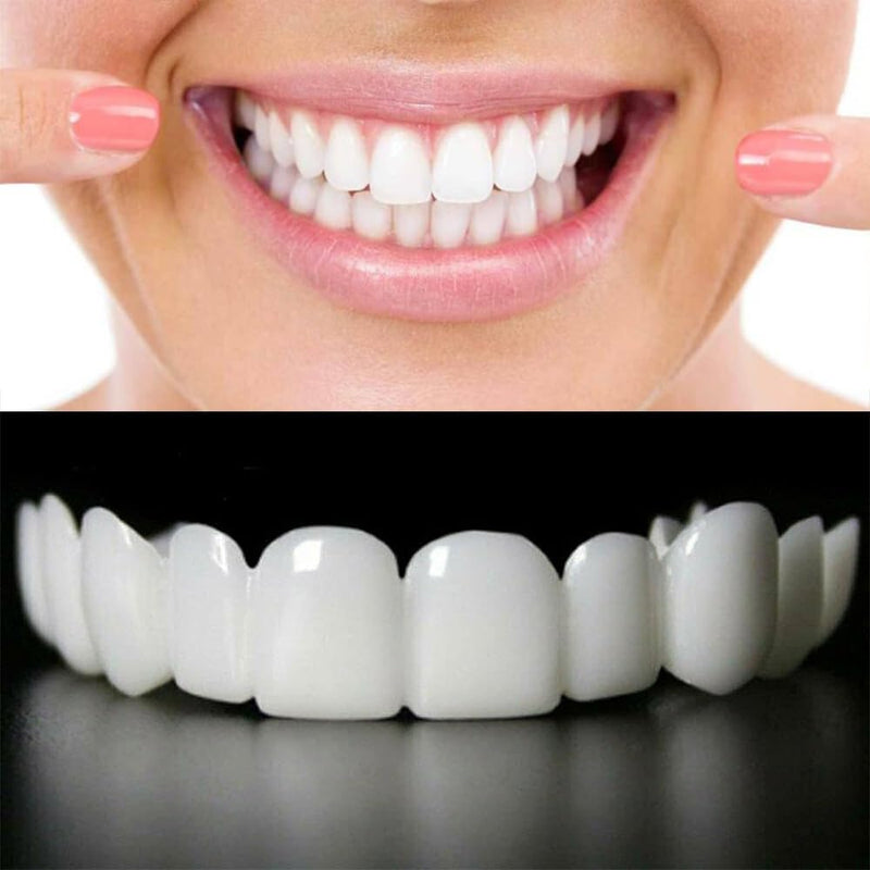 Snap On Smile