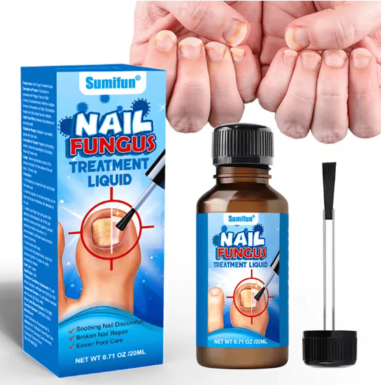 Sumifun Nail Fungus Treatment Liquid